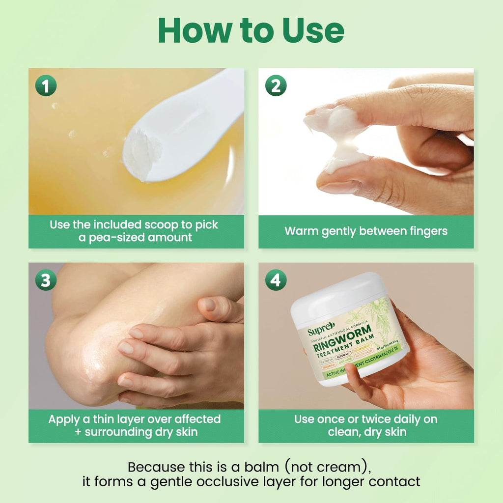 Ringworm Treatment for Humans Clotrimazole