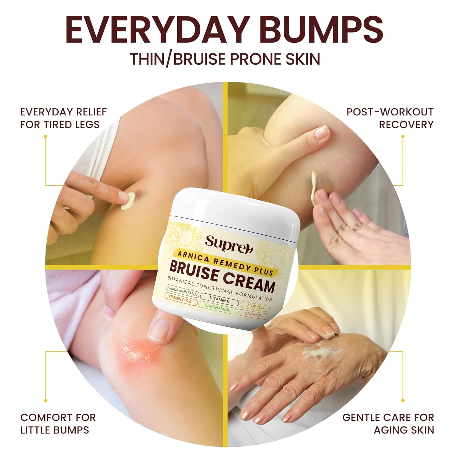 Arnica Bruise Cream Extra Strength