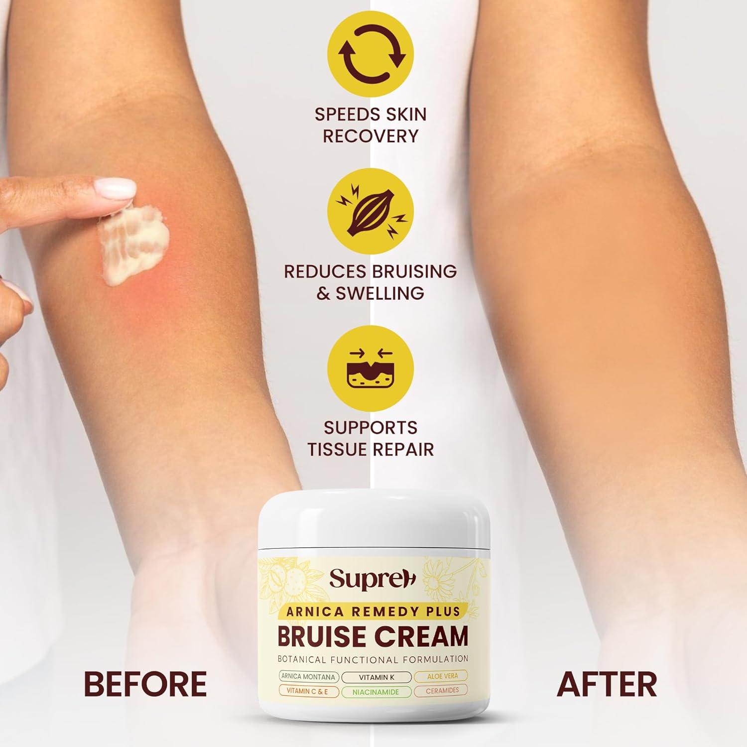Arnica Bruise Cream Extra Strength