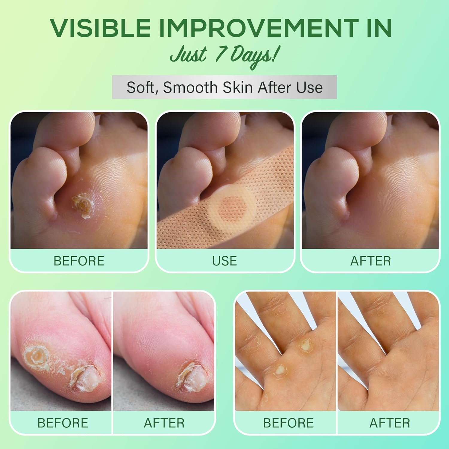 Corn Removers for Toes Feet Bandages