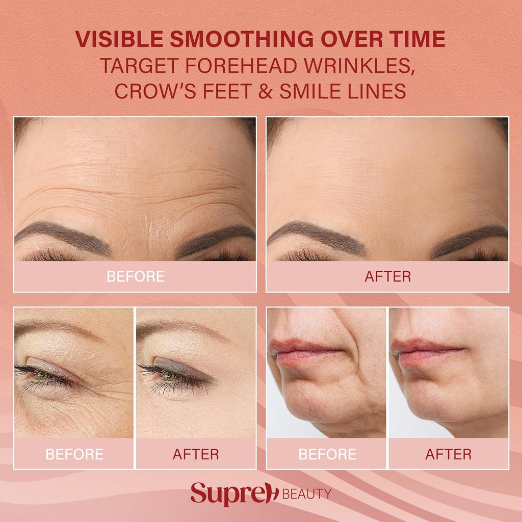 Forehead Wrinkle Patches For Anti-Wrinkle