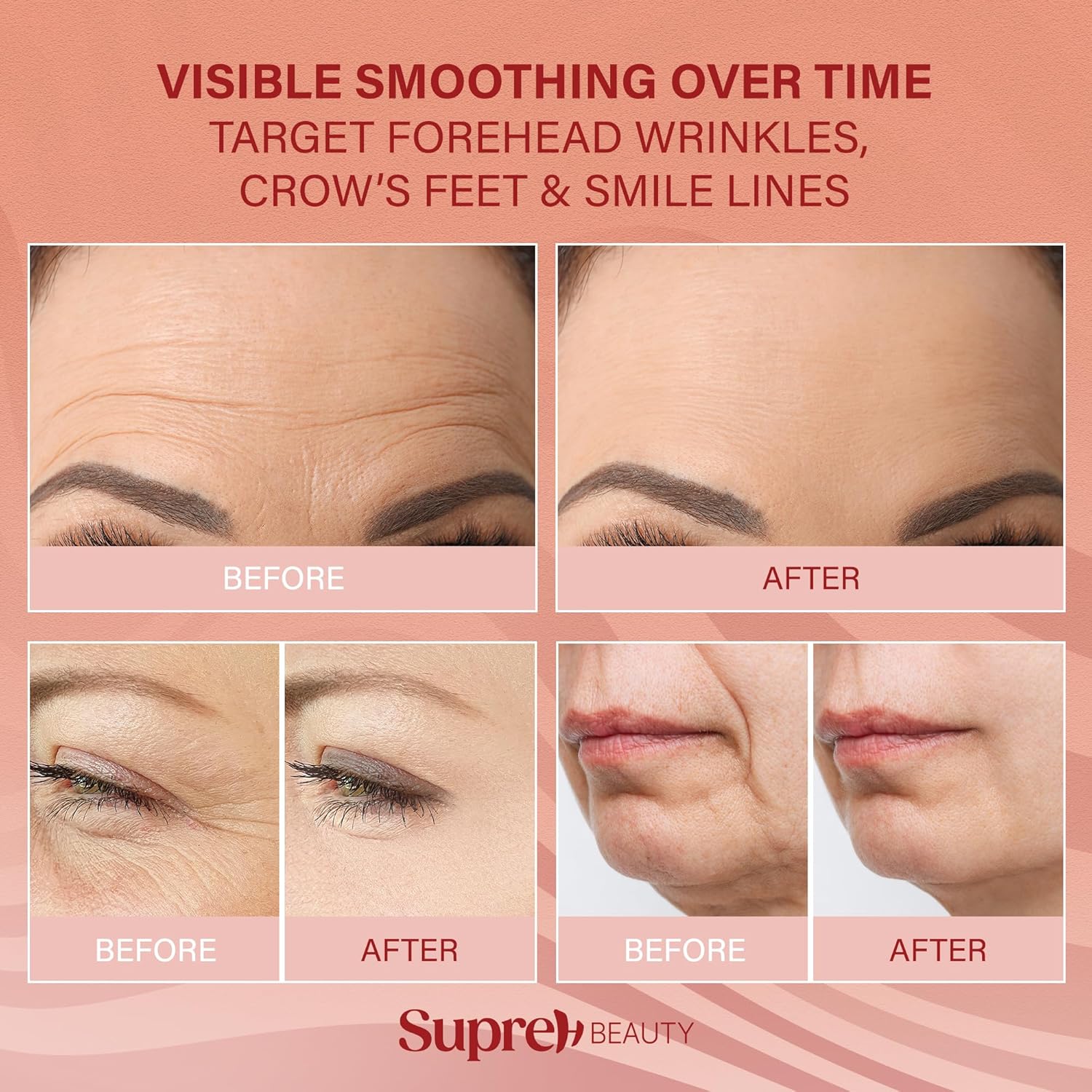 Forehead Wrinkle Patches For Anti-Wrinkle